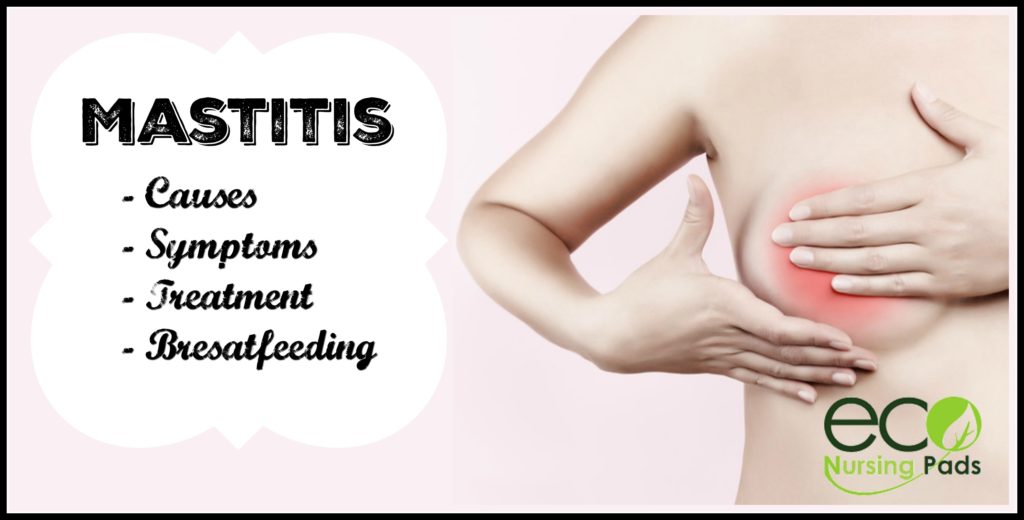 mastitis causes mastitis symptoms mastitis treatment mastitis breastfeeding